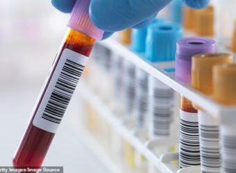 A blood test that can help prevent stroke victims from having another attack is now being offered on the NHS in a move that experts say will save lives. (File image)