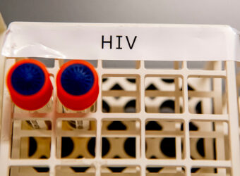 First woman reported cured of HIV after stem cell transplant | HIV/AIDS News